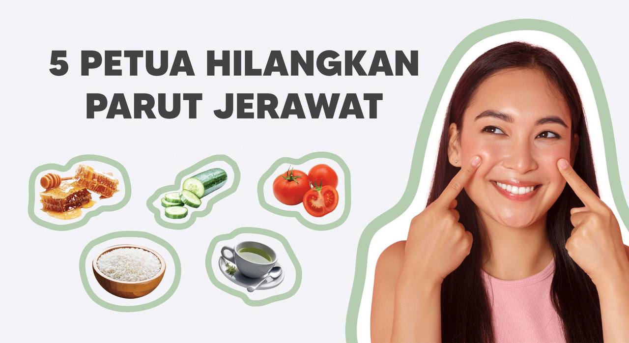 CARA HILANGKAN PARUT JERAWAT