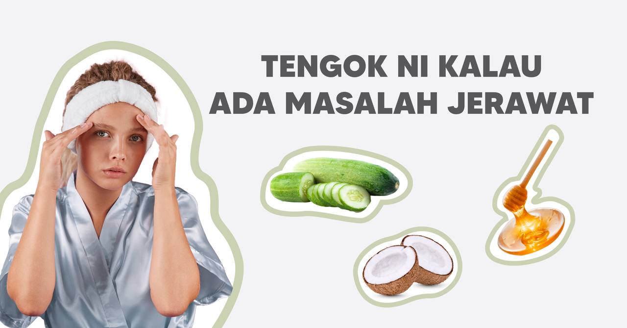 TENGOK NI KALAU ADA MASALAH JERAWAT