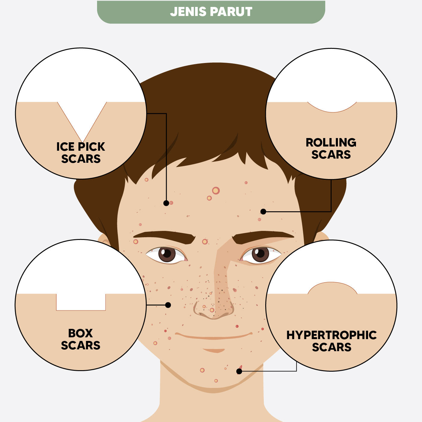 TEAMON Happiness Box - Scar Remover (2-Month Set)