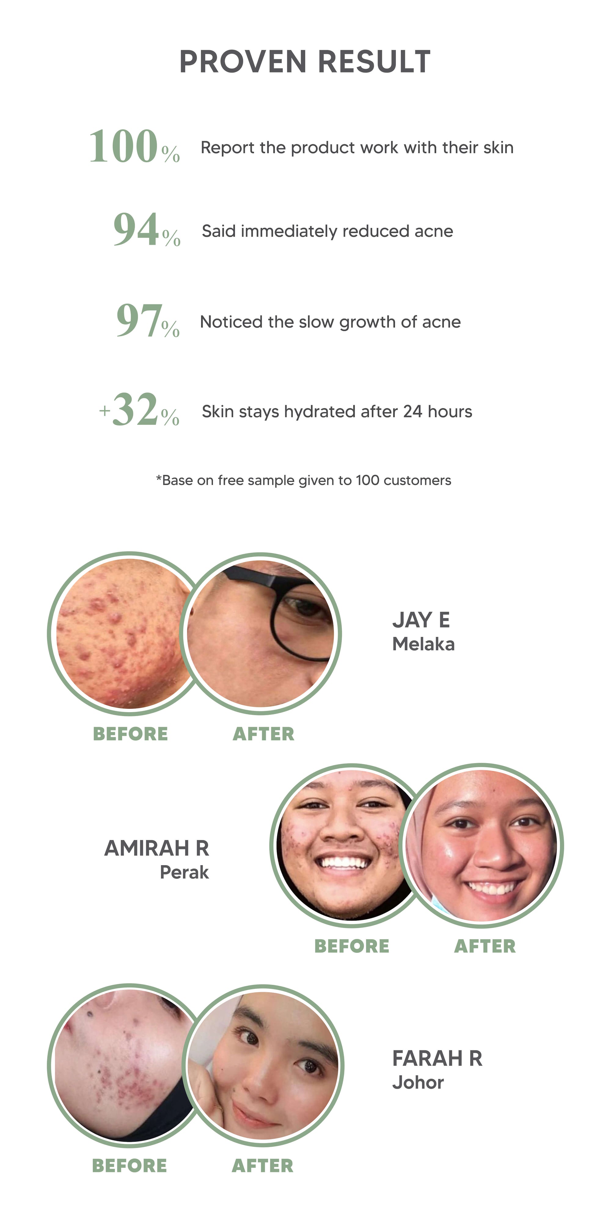 Jerawat, parut, ubat jerawat, rawatan jerawat, cara hilangkan jerawat, Teamonskin, Teamon Malaysia, cara putihkan kulit, petua putihkan kulit, cara hilangkan parut, tip hilangkan parut, tip hilangkan jerawat, jerawat pasir